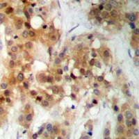 Anti-CK2 alpha Antibody