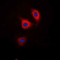 CTNND1 (Phospho-Y228) antibody