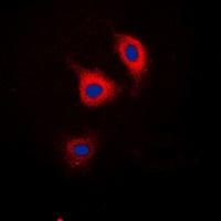 Anti-Catenin delta 1 (Phospho-Y228) Antibody