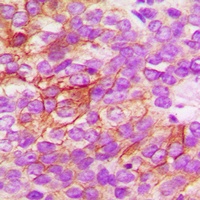 Anti-CD182 (Phospho-S347) Antibody