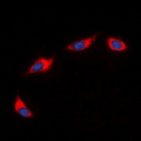 Anti-CD182 Antibody