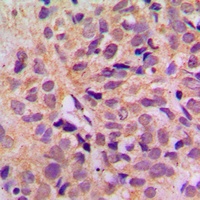 Anti-DDX3X Antibody