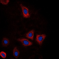 Anti-DDX3X Antibody
