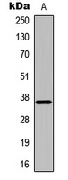 DOK5 Antibody