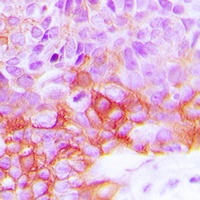 Anti-EGFR (Phospho-Y1092) Antibody