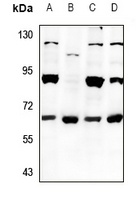 EIF2B4 Rabbit Polyclonal Antibody
