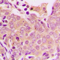 Anti-EIF4G1 Antibody