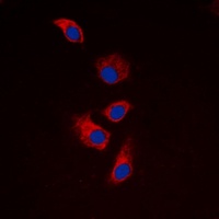 Anti-EIF4G1 Antibody
