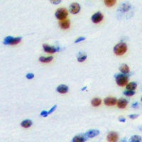 ELK1 antibody