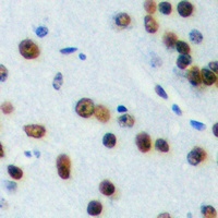 Anti-ELK1 (Phospho-T417) Antibody