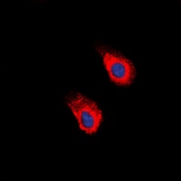 EPHA2 (Phospho-Y588/596) antibody