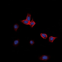 Anti-EPHA2 Antibody