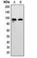 EPHA7 Rabbit Polyclonal Antibody