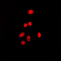 Estrogen Receptor beta (Phospho-S105) antibody