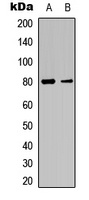 Factor XIII B Rabbit Polyclonal Antibody