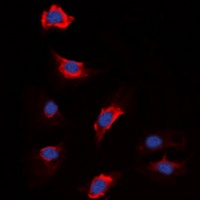 Anti-Factor XIII B Antibody