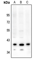 PAR4 Rabbit Polyclonal Antibody