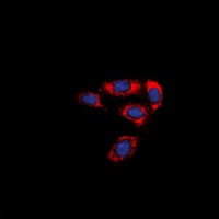 Anti-PAR4 Antibody