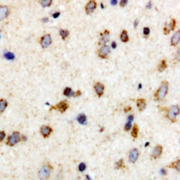 Anti-c-FER (Phospho-Y402) Antibody