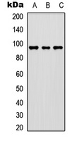 c-FER Rabbit Polyclonal Antibody