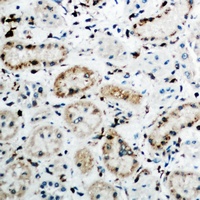 Anti-FGF19 Antibody