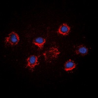 Anti-FGF19 Antibody