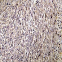 Anti-FGF22 Antibody