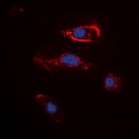 FGF22 antibody