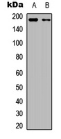 VEGFR1 Rabbit Polyclonal Antibody