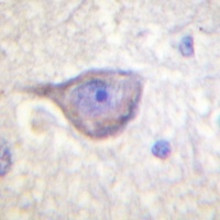 Anti-VEGFR1 Antibody