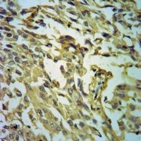 Anti-GDF9 Antibody