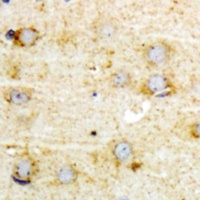Anti-GFAP (Phospho-S38) Antibody