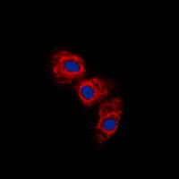 Anti-GFAP (Phospho-S38) Antibody