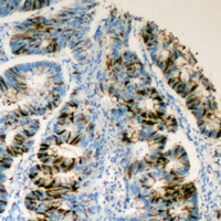 Anti-GPR116 Antibody