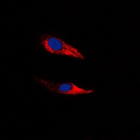Anti-GPR116 Antibody