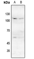 NMDAR1 (Phospho-S896) Antibody