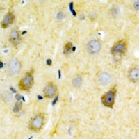 Anti-NMDAR2B (Phospho-Y1336) Antibody
