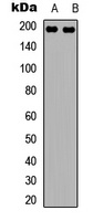 NMDAR2B Rabbit Polyclonal Antibody
