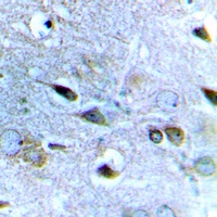NMDAR2B Rabbit Polyclonal Antibody