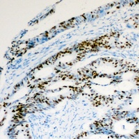 Anti-Histone H2A.Z (Acetyl-K5) Antibody