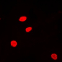 Anti-Histone H2A.Z (Acetyl-K5) Antibody
