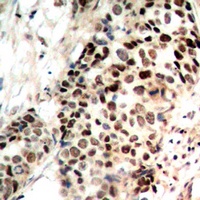 HDAC3 (Phospho-S424) antibody