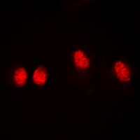 HDAC3 (Phospho-S424) antibody