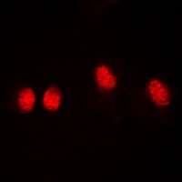 Anti-Histone Deacetylase 3 (Phospho-S424) Antibody