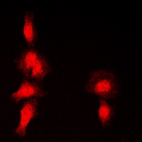Histone Deacetylase 7 (Phospho-S155) Antibody