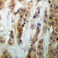 Anti-HEXIM1 Antibody