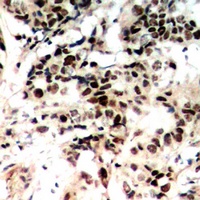 Anti-Histone H1 (Phospho-T17) Antibody
