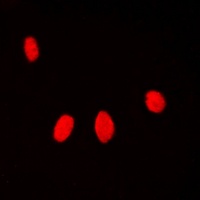 Anti-Histone H1 (Phospho-T17) Antibody