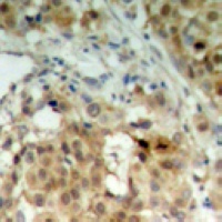 HNRNPK antibody