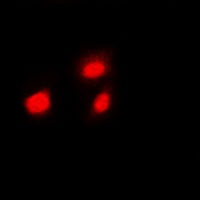 HSF1 (Phospho-S307) antibody